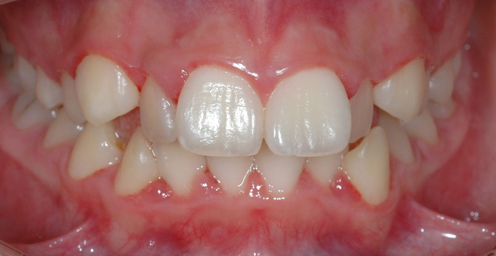 Dentista Ortodonzia Estetica Cernusco