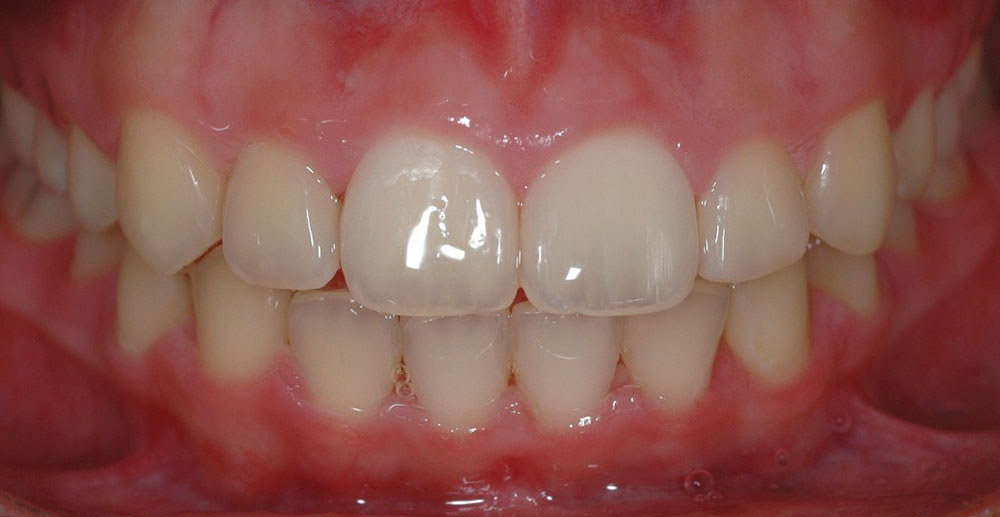 Dentista Ortodonzia Estetica Cernusco